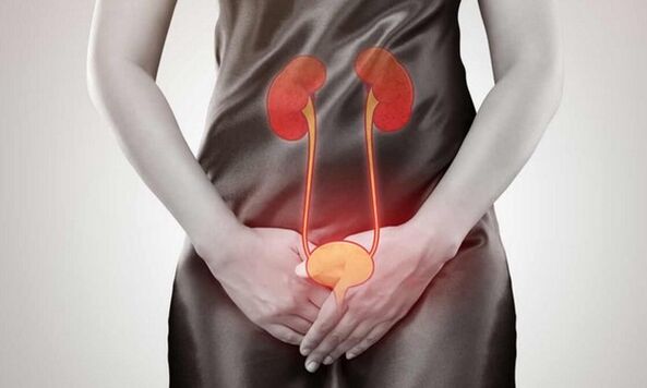 Causas e tratamento de cistite em mulheres